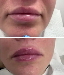 708e1a2b878a43fcaf67731840cd71-medycyna-estetyczna-kielce-pau-inspiration-521140ad99f942fd802200f1771d30-booksy